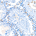Cyclin E Antibody in Immunohistochemistry (Paraffin) (IHC (P))