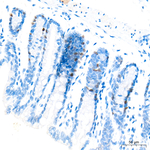 Cyclin E Antibody in Immunohistochemistry (Paraffin) (IHC (P))