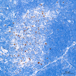 Cyclin E Antibody in Immunohistochemistry (Paraffin) (IHC (P))