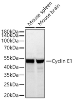 Cyclin E Antibody in Western Blot (WB)