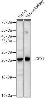 Glutathione Peroxidase 1 Recombinant Rabbit Monoclonal Antibody (9E5H3)