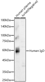 Human IgD Recombinant Rabbit Monoclonal Antibody (3N5F3)