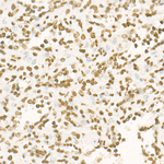 H3K27me3 Antibody in Immunohistochemistry (Paraffin) (IHC (P))