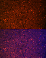 Arginase 1 Antibody in Immunohistochemistry (Paraffin) (IHC (P))