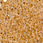 Arginase 1 Antibody in Immunohistochemistry (Paraffin) (IHC (P))