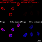 H3K9ac Recombinant Rabbit Monoclonal Antibody (9F4Q10)