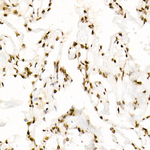 H3K9ac Antibody in Immunohistochemistry (Paraffin) (IHC (P))
