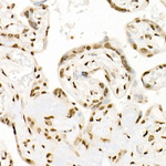 H3K9ac Antibody in Immunohistochemistry (Paraffin) (IHC (P))
