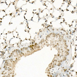 H3K9ac Antibody in Immunohistochemistry (Paraffin) (IHC (P))