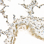H3K9ac Antibody in Immunohistochemistry (Paraffin) (IHC (P))