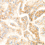 CD155 Antibody in Immunohistochemistry (Paraffin) (IHC (P))