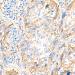 CD155 Antibody in Immunohistochemistry (Paraffin) (IHC (P))