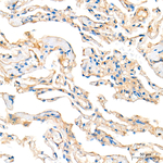 CD155 Antibody in Immunohistochemistry (Paraffin) (IHC (P))