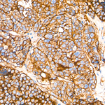 CD155 Recombinant Rabbit Monoclonal Antibody (1Z2B8)