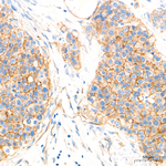 CD155 Antibody in Immunohistochemistry (Paraffin) (IHC (P))