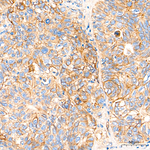 CD155 Antibody in Immunohistochemistry (Paraffin) (IHC (P))