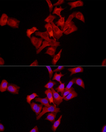 FASN Antibody in Immunocytochemistry (ICC/IF)
