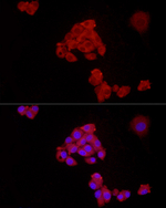 FASN Antibody in Immunocytochemistry (ICC/IF)