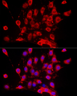 FASN Recombinant Rabbit Monoclonal Antibody (10F9J3)