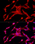 FASN Antibody in Immunocytochemistry (ICC/IF)
