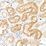 HEXA Recombinant Rabbit Monoclonal Antibody (9G4L9)