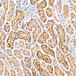 HEXA Antibody in Immunohistochemistry (Paraffin) (IHC (P))