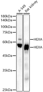 HEXA Antibody in Western Blot (WB)