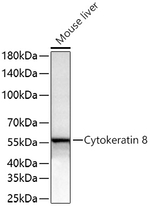Cytokeratin 8 Antibody in Western Blot (WB)