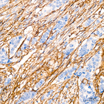 CD13 Antibody in Immunohistochemistry (Paraffin) (IHC (P))