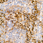 CD13 Antibody in Immunohistochemistry (Paraffin) (IHC (P))