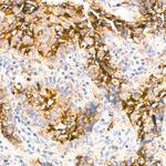 CD13 Antibody in Immunohistochemistry (Paraffin) (IHC (P))