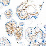 CD13 Antibody in Immunohistochemistry (Paraffin) (IHC (P))
