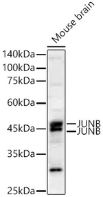 JunB Recombinant Rabbit Monoclonal Antibody (1N5P1)