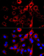 SQSTM1 Recombinant Rabbit Monoclonal Antibody (6A7L9)