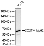 SQSTM1 Antibody in Western Blot (WB)
