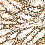 HP1 beta Antibody in Immunohistochemistry (Paraffin) (IHC (P))