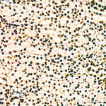 HP1 beta Antibody in Immunohistochemistry (Paraffin) (IHC (P))
