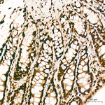 HP1 beta Antibody in Immunohistochemistry (Paraffin) (IHC (P))