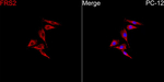 FRS2 Recombinant Rabbit Monoclonal Antibody (10L1P2)