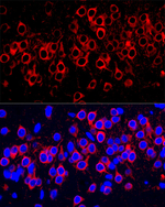 WFS1 Antibody in Immunohistochemistry (Paraffin) (IHC (P))