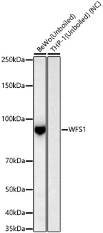 WFS1 Antibody in Western Blot (WB)