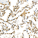 ICAM-2 Recombinant Rabbit Monoclonal Antibody (7K9H6)
