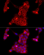 CD29 Recombinant Rabbit Monoclonal Antibody (2W3N1)