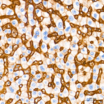 CD29 Antibody in Immunohistochemistry (Paraffin) (IHC (P))