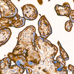 CD29 Antibody in Immunohistochemistry (Paraffin) (IHC (P))