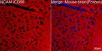 CD56 Antibody in Immunohistochemistry (Frozen) (IHC (F))