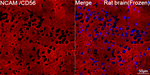 CD56 Antibody in Immunohistochemistry (Frozen) (IHC (F))