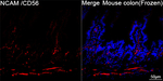 CD56 Antibody in Immunohistochemistry (Frozen) (IHC (F))