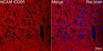 CD56 Antibody in Immunohistochemistry (Paraffin) (IHC (P))