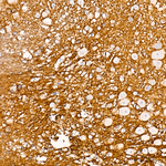 CD56 Antibody in Immunohistochemistry (Paraffin) (IHC (P))